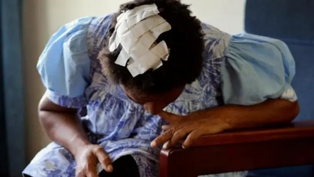 Eni ti wọ́n fọ lórí