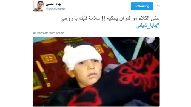 صورة للطفل اثناء تلقيه العلاج