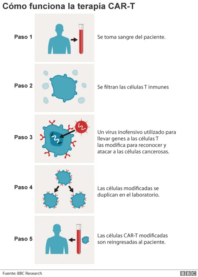 Un gráfico explicando la terapia CAR-T