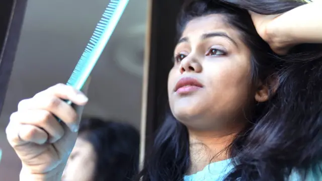 ઍલોપેશિયા