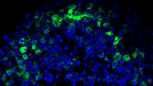 Fotografia feita por microscópio apresenta neuroesferas (pontos azuis) e coronavírus (pontos verdes)