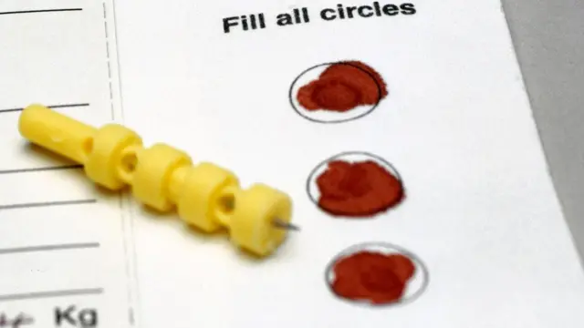 La recolección sin autorización de los resultados del "pinchazo en el talón" plantea serios dilemas éticos a los investigadores.