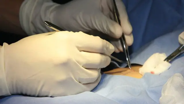 Хирург који оперише