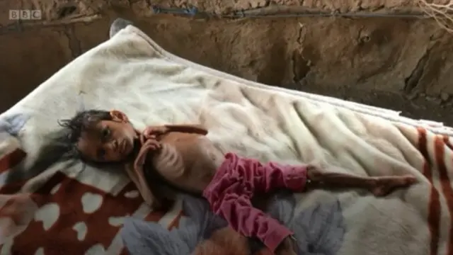 طفل طريح الفراش