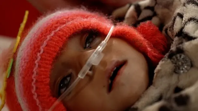 Imagen de Walid con oxígeno