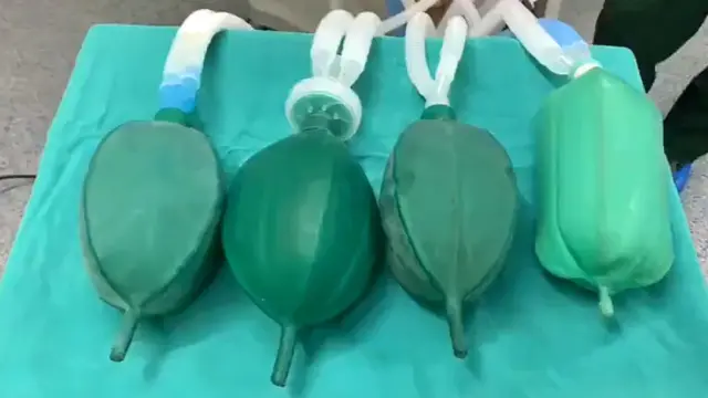 Сплиттер сунъий ўпкаларда синаб кўрилди