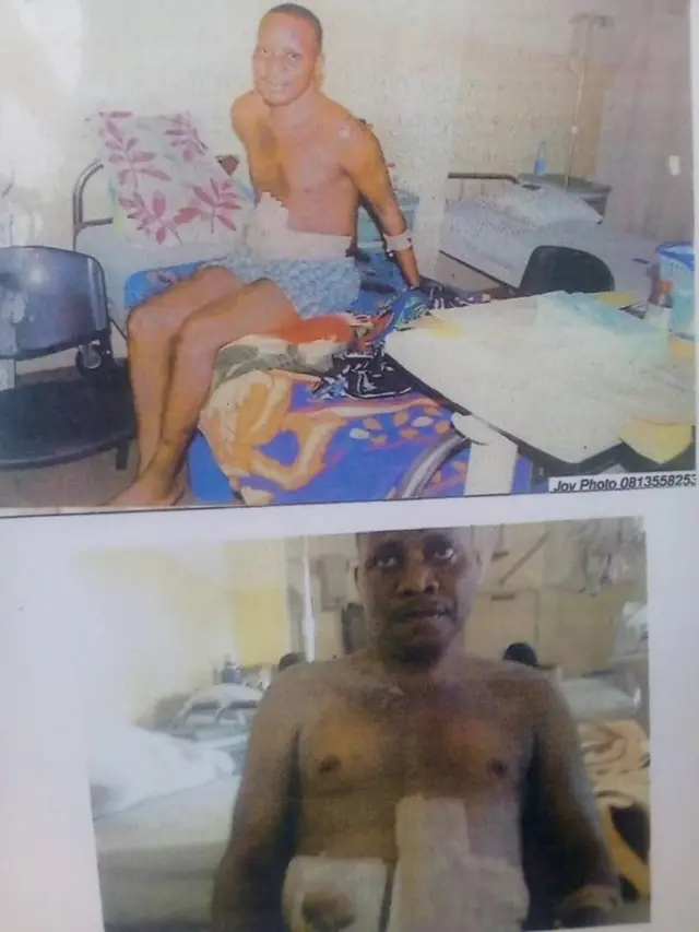 M Thomas seven years ago for hospital.