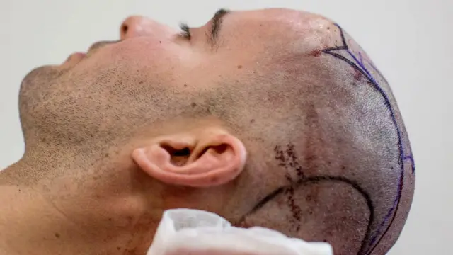 સમગ્ર બાબતોને ધ્યાને લીધા બાદ વિસેરા એફએસએલને મોકલવામાં આવ્યા છે. (ફાઇલ ફોટો)