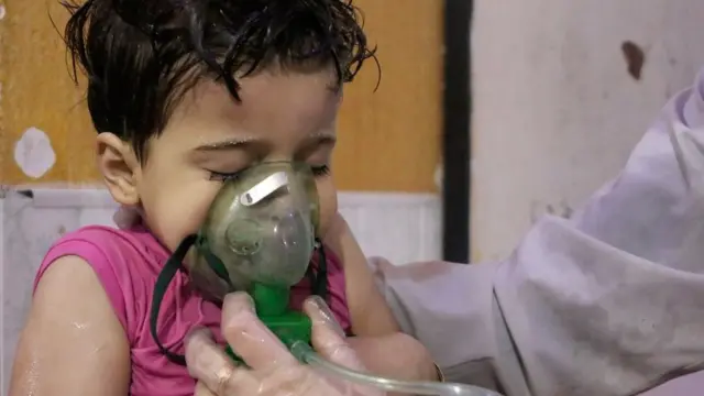 Хлопчик із респіратором