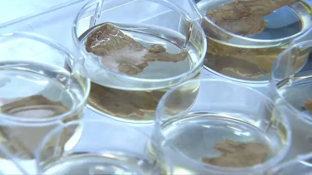 இறைச்சி.