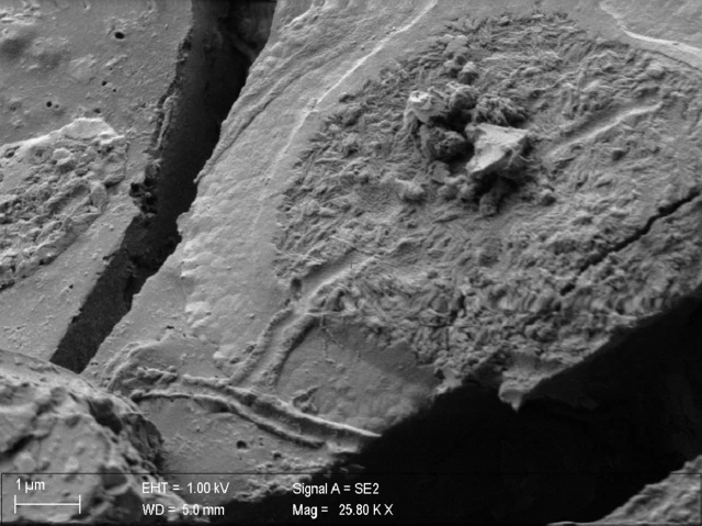 Imagen de tomografía de neuronas de la médula espinal.