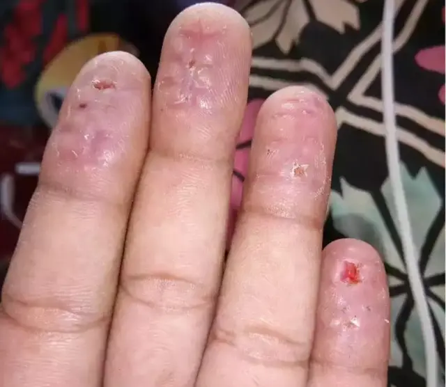 వేలిముద్రల మార్పిడి ముఠా