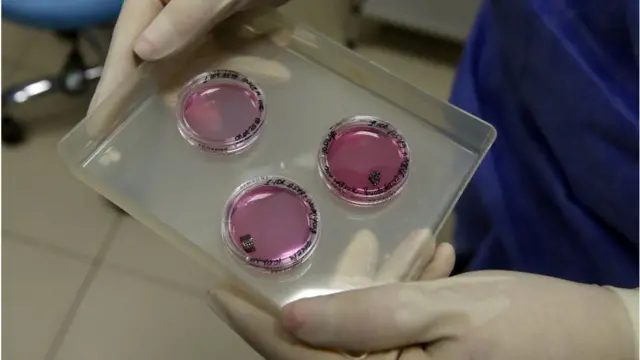 రక్త పరీక్ష