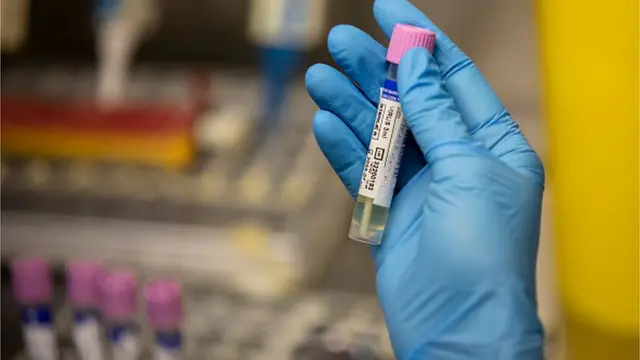 вірус мавпячої віспи