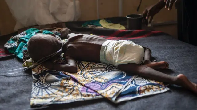 aworan ọmọde tí kò rí ounjẹ jẹ