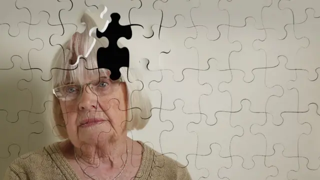 ilustración - alzhéimer