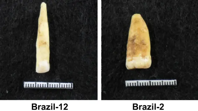 Duas fotosaposta e ganhadentes analisados