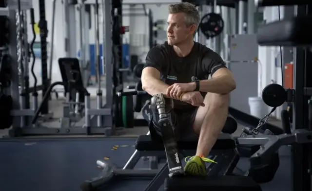 의족을 착용한 채 앉아있는 존