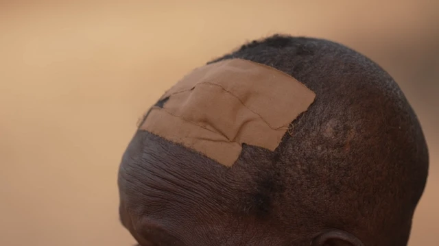 A close up of the top of someone's head with a large plaster clearly see on the top.