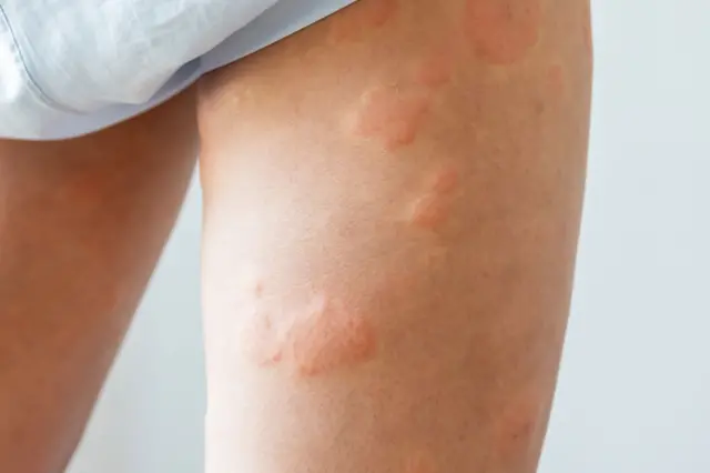 علامتی تصویر 