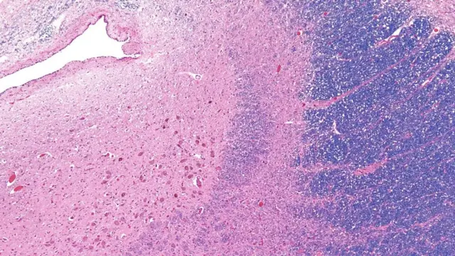 झोप, आरोग्य