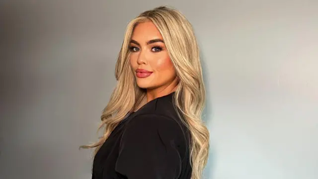 વાળ ખરવા કે ઉતરવા, ટાલ પડવી, વાળની સંભાળ, ઍલોપીસિયા, બીબીસી 100 વુમન, ઑલિવિયા મૅકવિગ, માથાની વિગ, ઇન્સ્ટાગ્રામ, ટીકટૉક