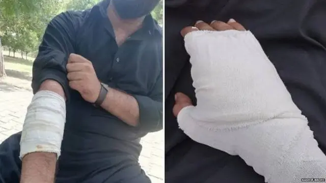 గాయపడిన పంజాబ్ యూనివర్సిటీ విద్యార్థి 