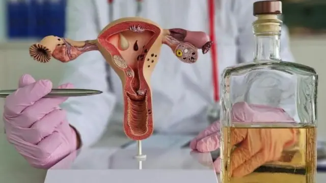 મહિલા, હ્રદયરોગ, માસિકસ્ત્રાવ, સ્વાસ્થ્ય, બીબીસી ગુજરાતી 