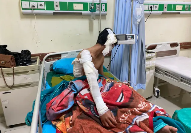 Suryadi Maryana, korban tumpahan soda api di Bandung Barat, dirawat di RSUD Cikalongwetan, Rabu (25/12).