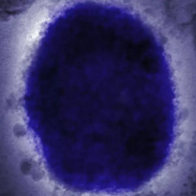 Foto gosiri etu nje ọrịa Monkey Pox dị 