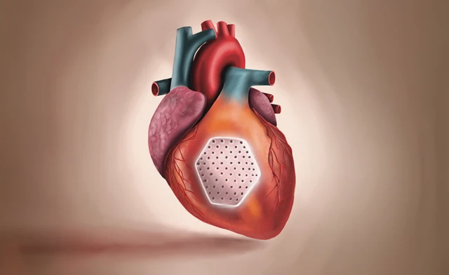 ภาพจำลองแผ่นกล้ามเนื้อหัวใจเทียมที่สร้างจากเทคนิควิศวกรรมชีวภาพ