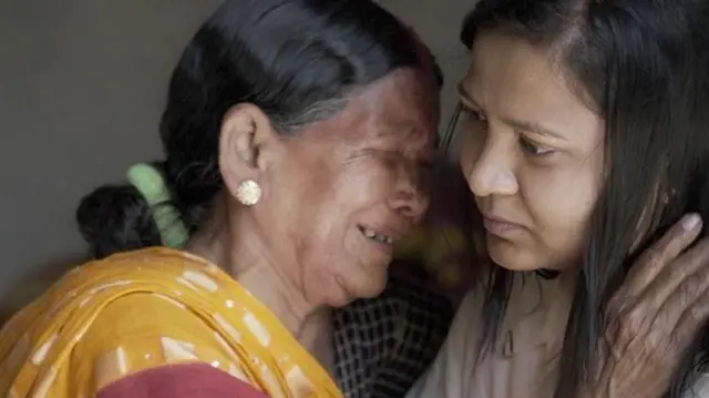 பெண் சிசுக் கொலைகளை நிறுத்தி, அவர்களை காப்பாற்றிய மருத்துவச்சிகள்