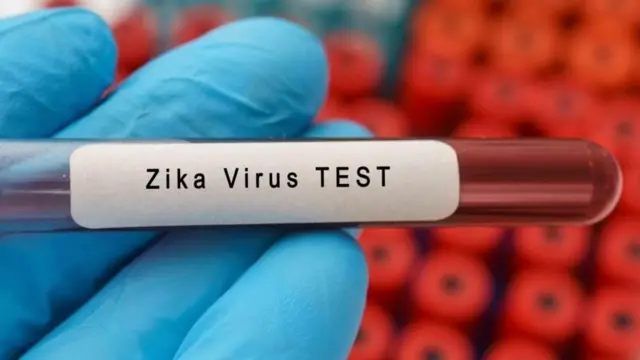 ઝિકા વાઇરસ, મચ્છર, બીબીસી ગુજરાતી, ગુજરાત, વાઇરસ ચેપ
