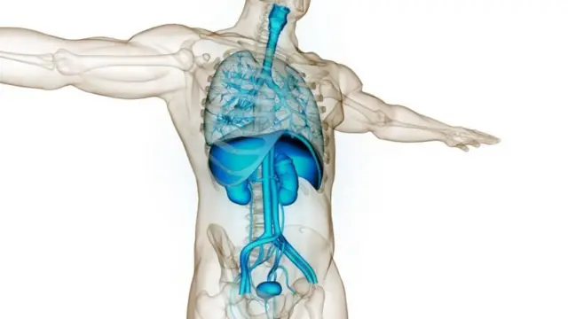 گردے کی پتھری