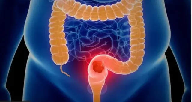 Kaansariin marrumaanii attamiin adda bahu danda'a?