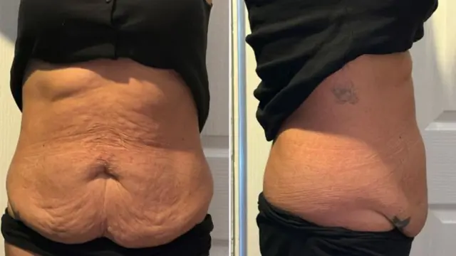 शर्माइनको पेट