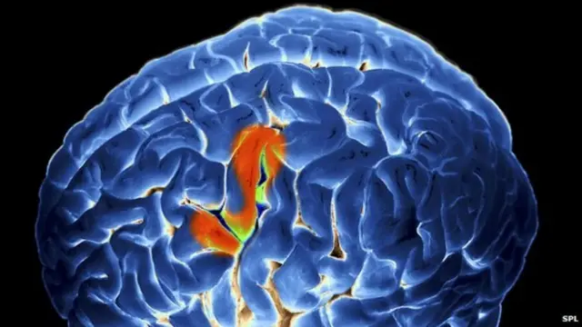 መብዛሕትኡ ከባቢታት ሓንጎል ወዲ ሰብ ሓደስቲ ዋህዮታት ሓንጎል ከዕብዩ ኣይክእሉን