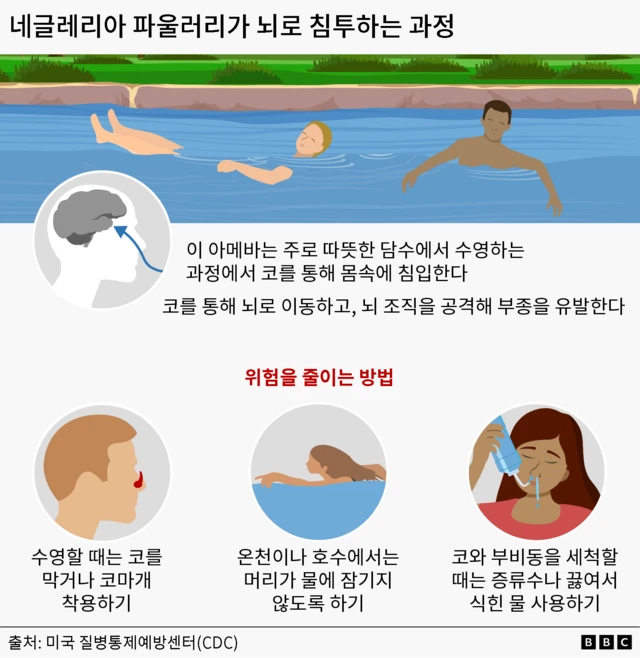 아메바가 체내 침투하는 경로 및 예방법