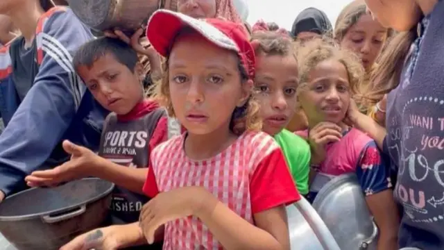 খাদ্য সংকটে অপুষ্টিসহ ভয়াবহ পরিস্থিতিতে পড়েছে গাজার শিশুরা