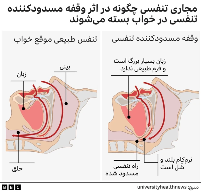 گرافیک خواب
