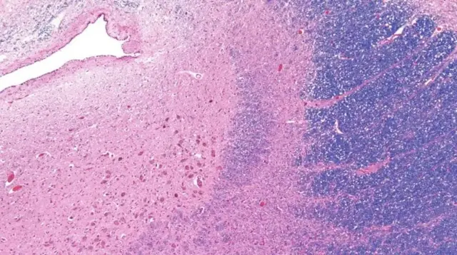 نیلي ټکي خپل روښانه نیلي رنګ د (نیوروټرانسمیټر نورپینفرین) له خوشې کېدوترلاسه کوي.