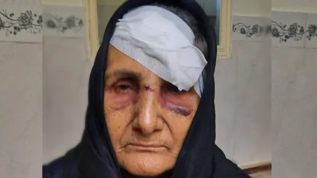 گوهر عشقی بر اثر حمله دو موتورسوار مجروح شد