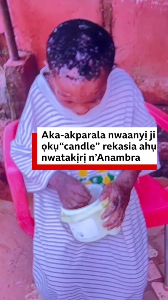 Nwa  nne ya ukwu na-emegbu