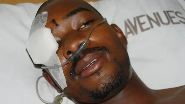 Bw Chamisa alipasuka fuvu la kichwa alipopigwa katika msako mkali dhidi ya upinzani mwaka wa 2007.