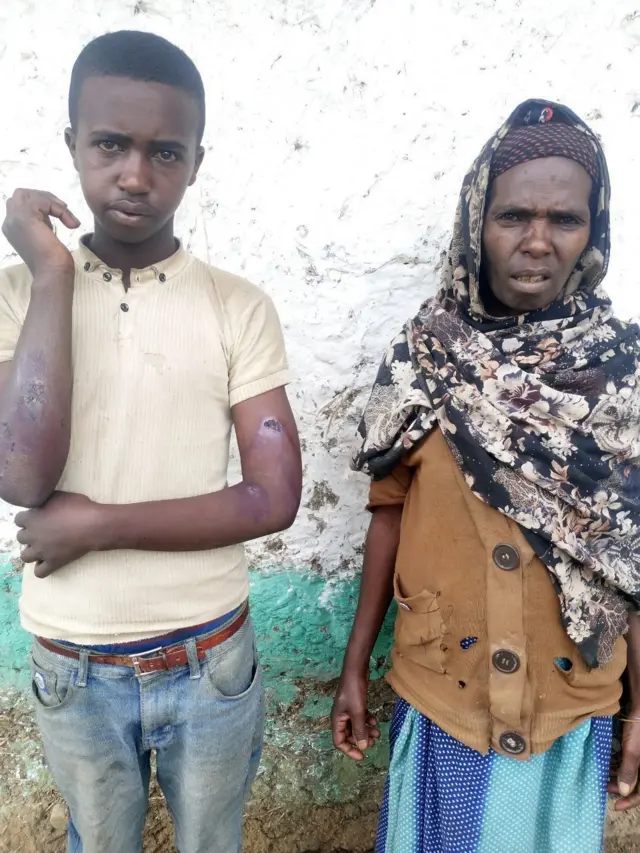 haadhaafi ilma qeerramsi miidhe