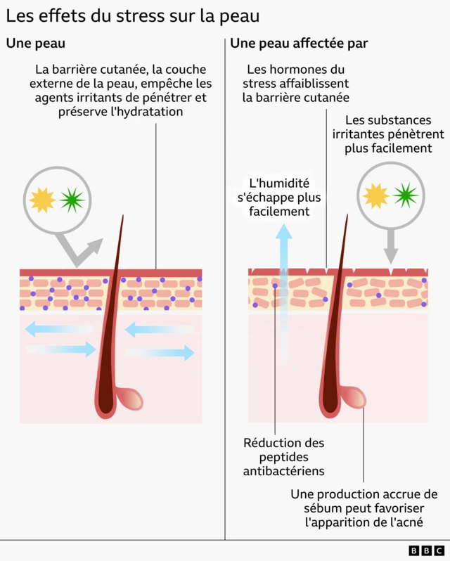 Illustration montrant la différence entre une peau saine et une peau affectée par le stress. Sur la peau affectée par le stress, la barrière cutanée externe présente de petites fissures, et la structure en briques des cellules situées en dessous est désorganisée, ce qui favorise la perte d'hydratation et facilite la pénétration des agents irritants.