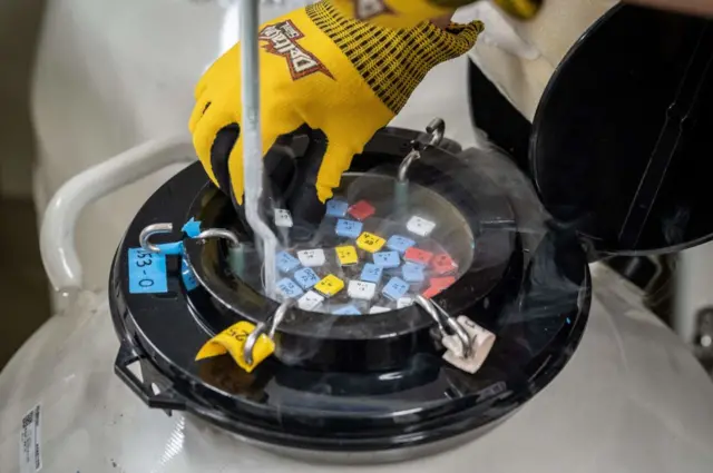 ਸ਼ੁਕਰਾਣੂ