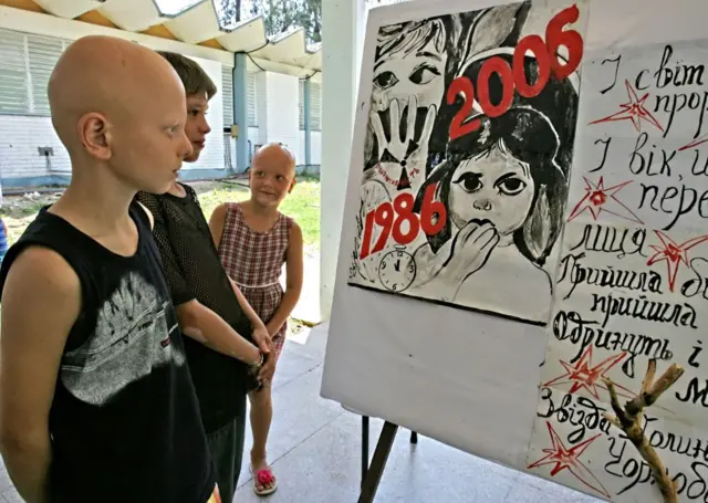 Un grupo de niños, dos de ellos sin cabello, miran carteles donde se lee "1986, 2006"