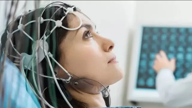 అల్జీమర్స్