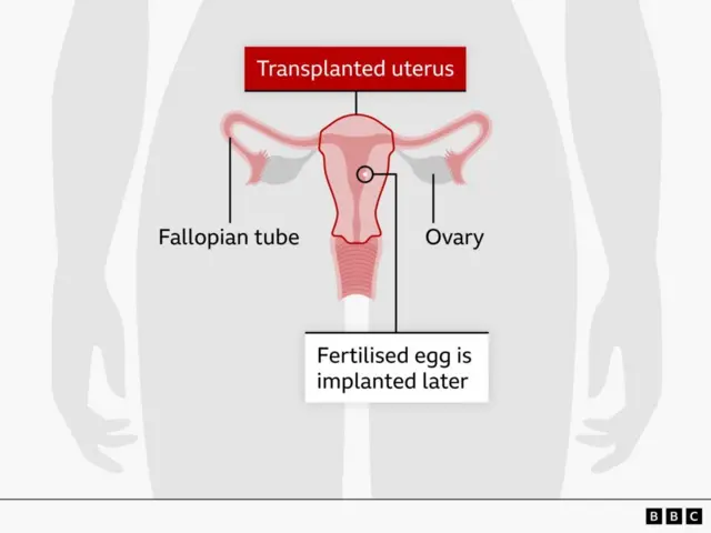 प्रातिनिधीक फोटो 